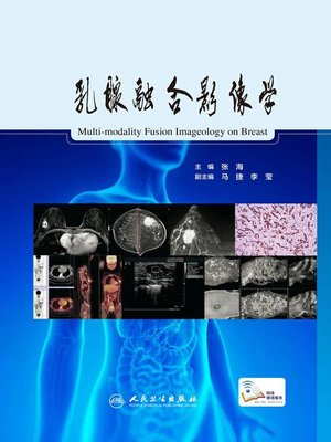 cover image of 乳腺融合影像学